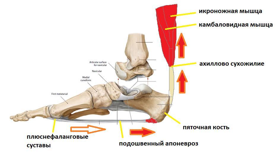 Подошвенная шпора